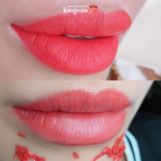 Môi sau khi bong lên màu tự nhiên, sắc môi tươi tắn và không bị khô