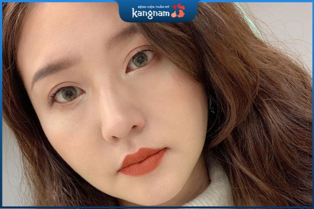 môi cam đất đã bong