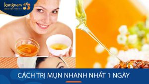 Bí quyết trị mụn cấp tốc trong 1 ngày – Làn da sáng mịn bất ngờ