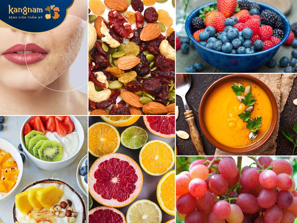 Duy trì chế độ ăn uống, sinh hoạt lành mạnh để đẩy lùi mụn cám lỗ chân lông to