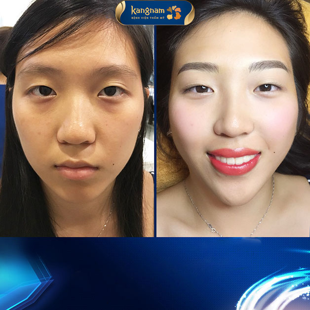 Khách hàng tại Kangnam thay đổi diện mạo sau khi phun mày