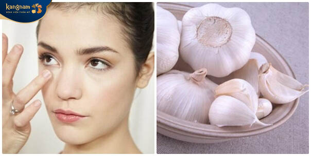 Tỏi có thể điều trị các đốm mụn mới hình thành