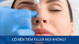 Có nên tiêm filler mũi không? Điều cần biết trước khi quyết định