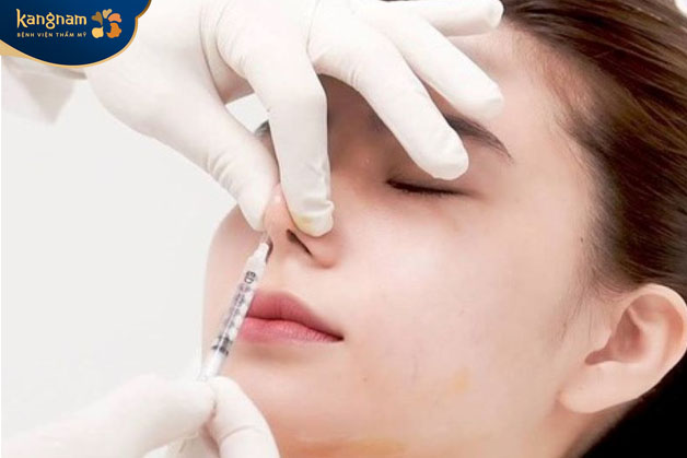 Tiêm filler mũi là phương pháp làm đẹp không can thiệp phẫu thuật