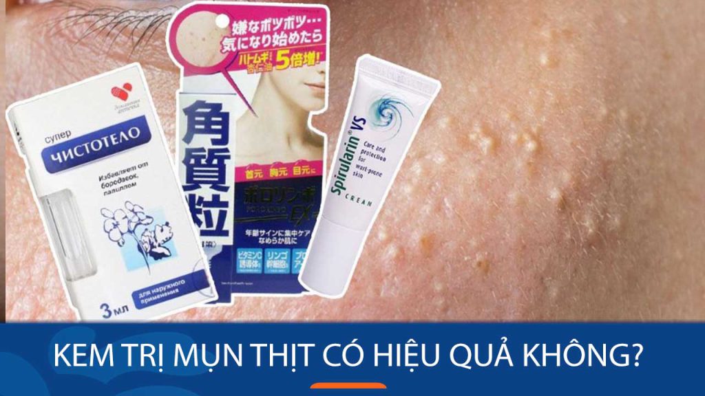 Kem trị mụn thịt có hiệu quả không? Giải pháp cho làn da sần sùi
