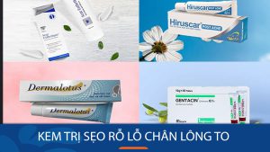 15+ Kem Trị Sẹo Rỗ & Se Khít Lỗ Chân Lông Hiệu Quả 2024 | So Sánh & Đánh Giá