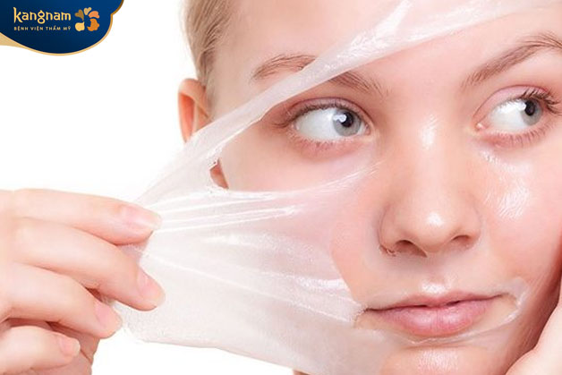 Lột da hóa học là phương pháp trị sẹo lồi bằng hóa chất