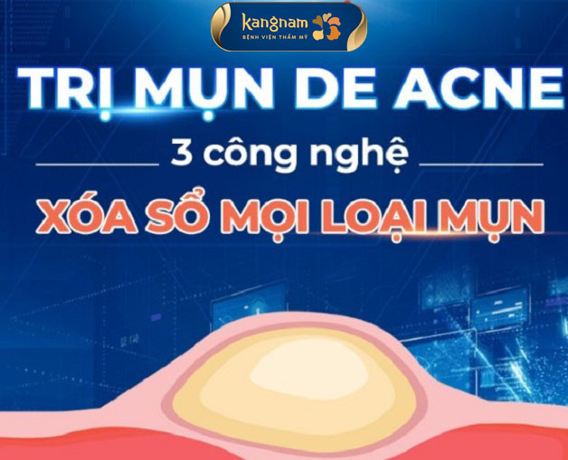 Công nghệ điều trị mụn De Acne tích hợp 3 trong 1