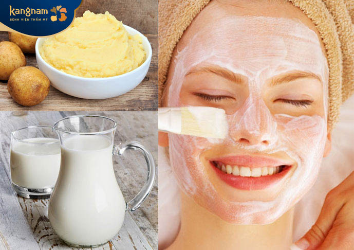 Khoai tây và sữa chua là cách trị mụn cám hiệu quả