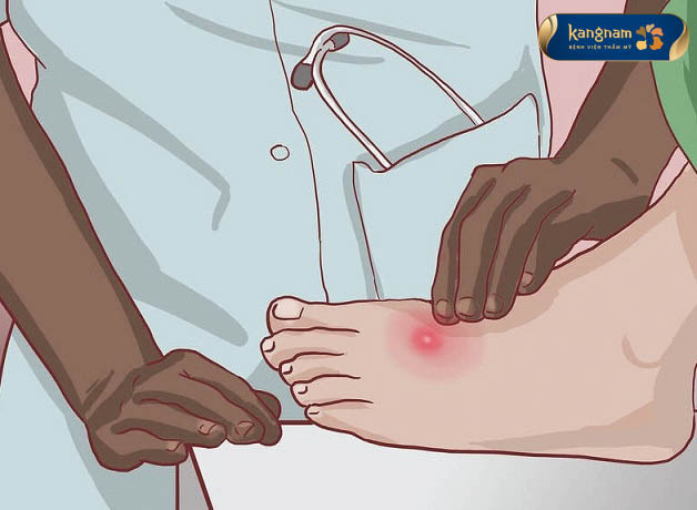 Bác sĩ thăm khám, chẩn đoán mụn nhọt ở chân