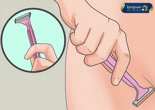 Sử dụng cao cạo không đúng cách gây mụn thịt ở vùng nhạy cảm