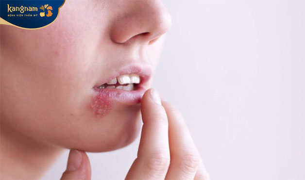 Việc đầu tiên cần xem xét tình trạng mụn 