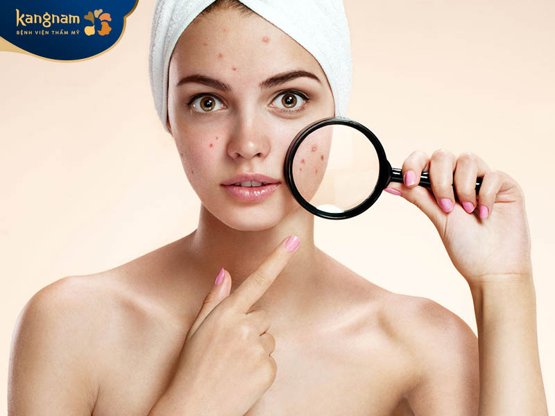 Có nhiều nguyên nhân hình thành mụn trên da