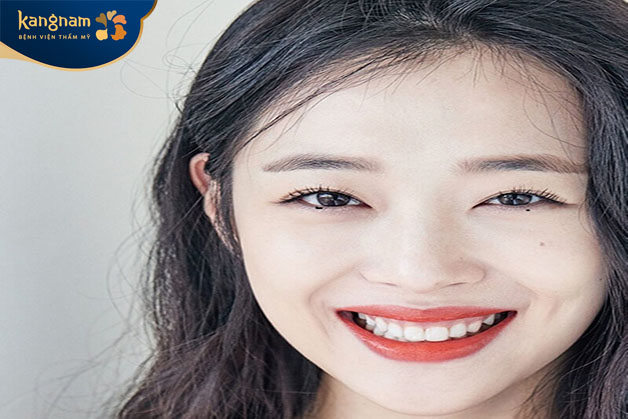 Cái tên của nó bắt nguồn từ vị trí giọt lệ đi qua trên mặt