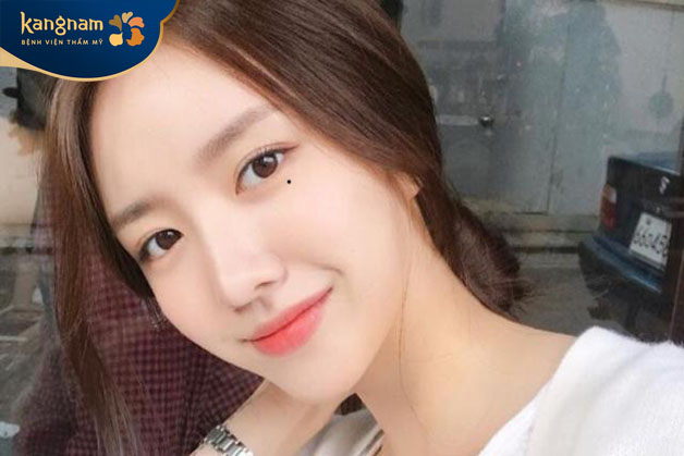 Vị trí nốt ruồi tồn tại liên quan đến câu chuyện tình cảm kéo dài nhiều kiếp