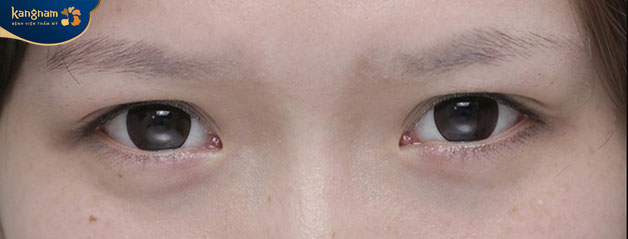 Lông mày nhạt màu sau khi phun cần dặm lại cho sắc nét 