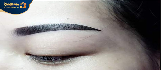 Phun mày công nghệ cũ sẽ khiến bạn già hơn nhiều 