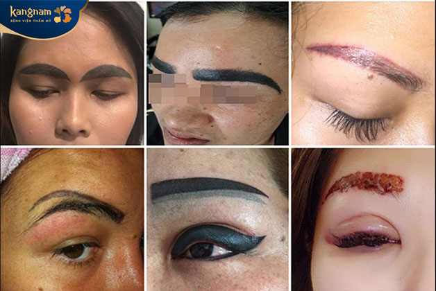 Những trường hợp phun xăm bị hỏng, lỗi tại các cơ sở không uy tín 