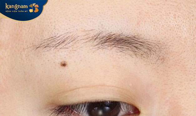 Lông mày ngắt đoạn vừa ảnh hưởng đến ngoại hình vừa ảnh hưởng vận mệnh