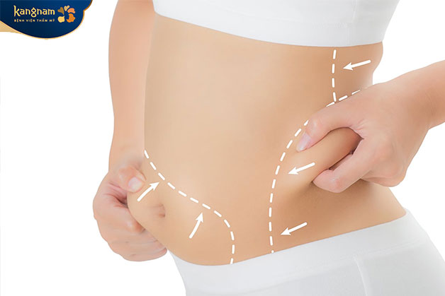 Mỡ bụng gây ảnh hưởng đến tính thẩm mỹ