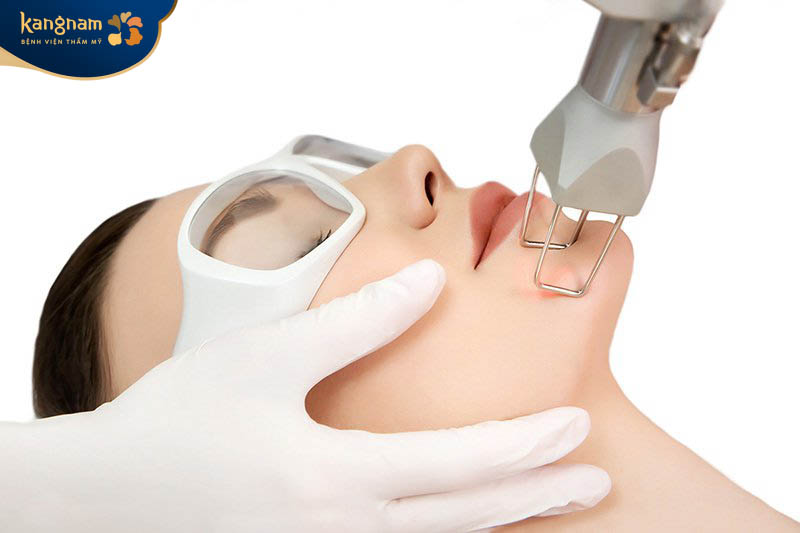 Công nghệ trị sẹo Laser Fractional CO2