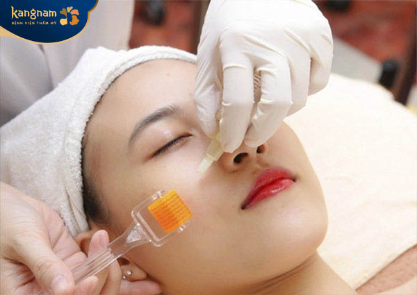 Phương pháp lăn kim, phi kim