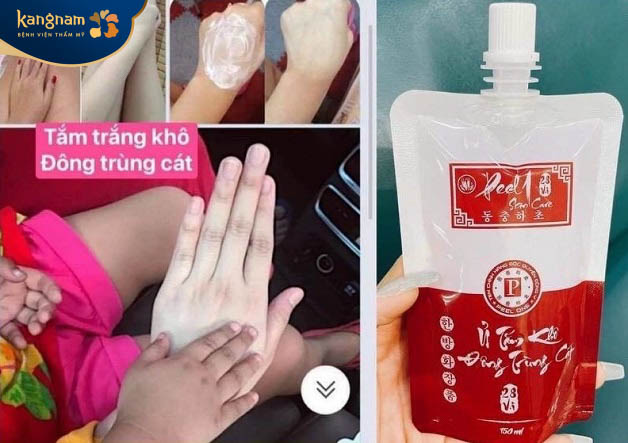 Tắm trắng khô Đông trùng cát