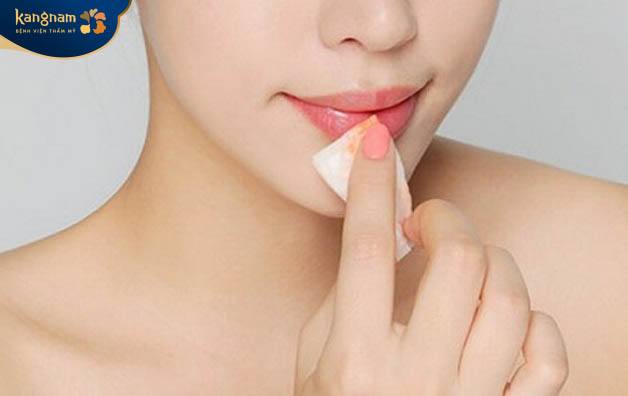 Vệ sinh môi hàng ngày sau tiêm filler