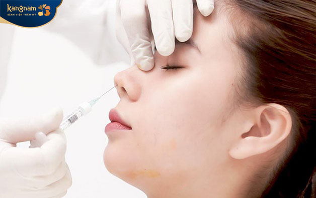 Filler được tiêm vào để giúp nâng cao sống mũi
