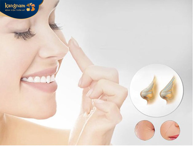 Phương pháp này phù hợp với tất cả mọi người có nhu cầu nâng mũi không muốn phẫu thuật