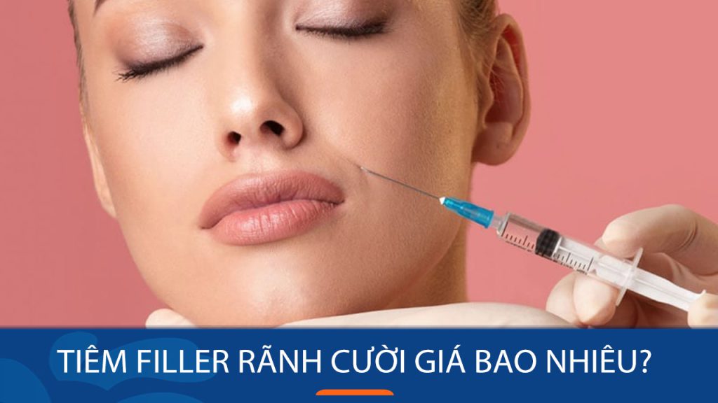 Tiêm filler rãnh cười giá bao nhiêu? Bảng giá mới