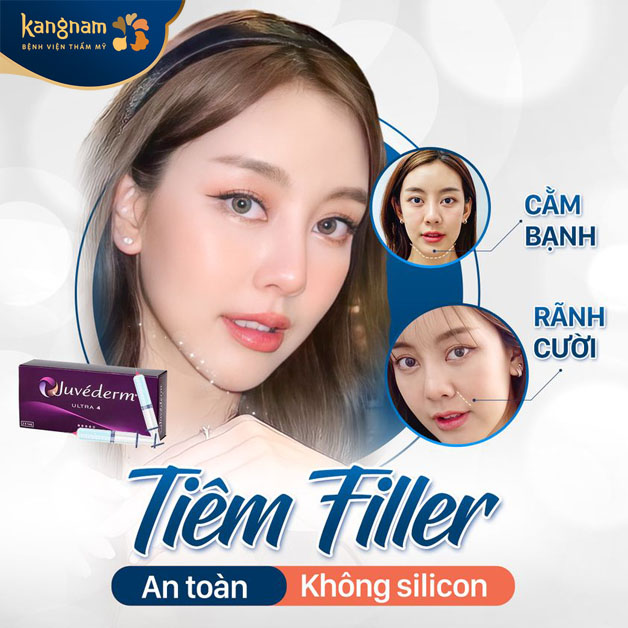 Hiệu quả tức thì sau khi tiêm filler xóa rãnh cười tại Kangnam