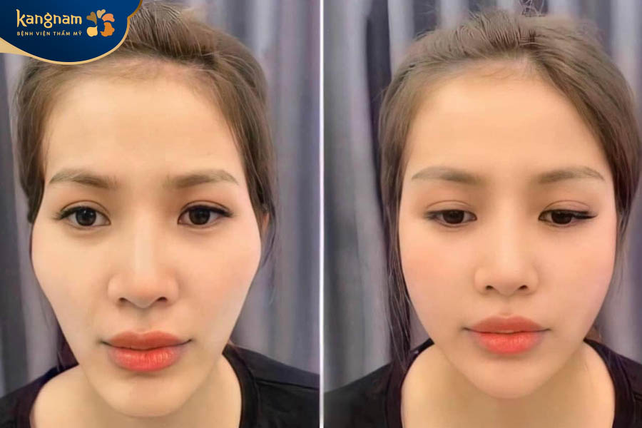 Hỗ trợ trẻ hóa làn da, kích thích sản sinh collagen