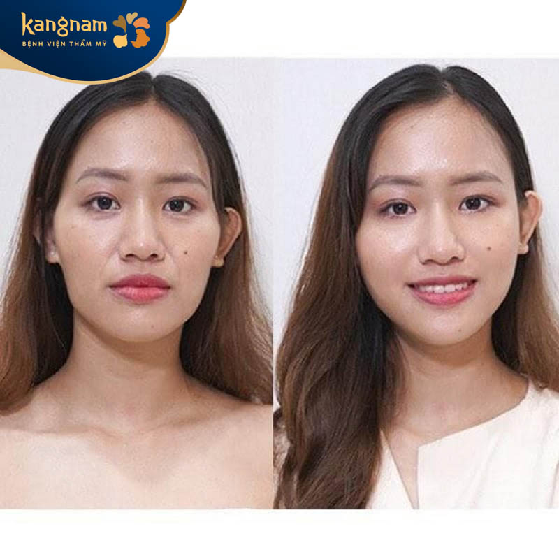 An toàn, giúp làn da sáng mịn, tươi trẻ