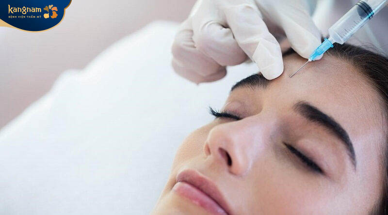 Tiêm filler trán vẫn tồn tại một số nhược điểm