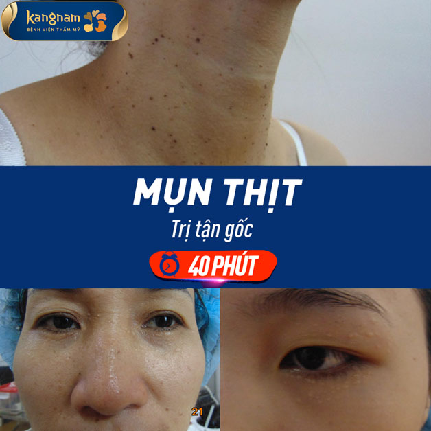 Phác đồ điều trị cá nhân hóa, nhanh chóng, tiết kiệm thời gian