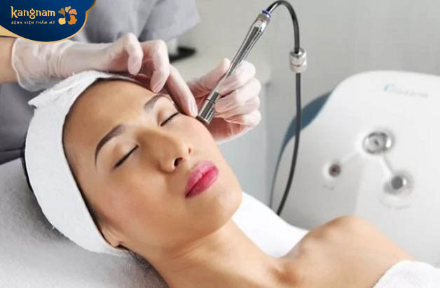 Trị tàn nhang bằng phương pháp laser