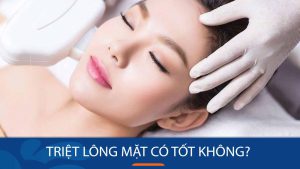 Triệt lông mặt có tốt không? Giải đáp từ chuyên gia da liễu