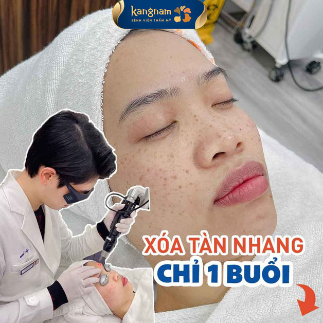 Bác sĩ trực tiếp thực hiện xoá tàn nhang