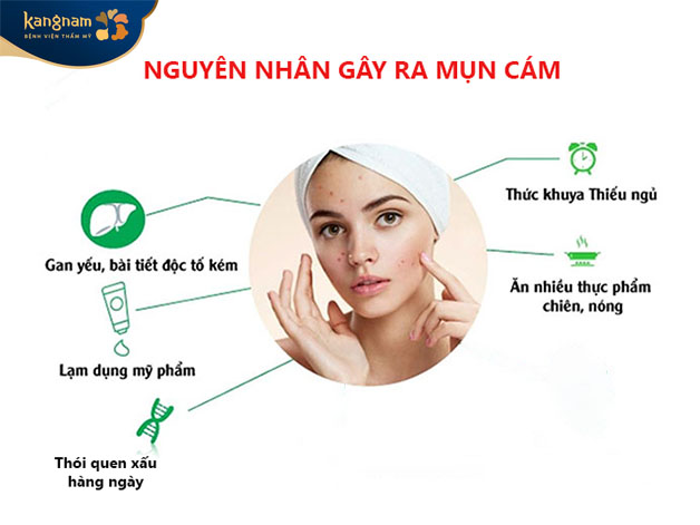 Hình thành mụn cám do nhiều lý do khác nhau