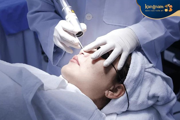 Phương pháp nâng cao giúp loại bỏ mụn thịt nhanh chóng 