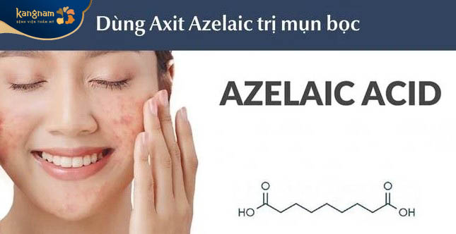 Cách trị mụn bọc với Axit Azelaic