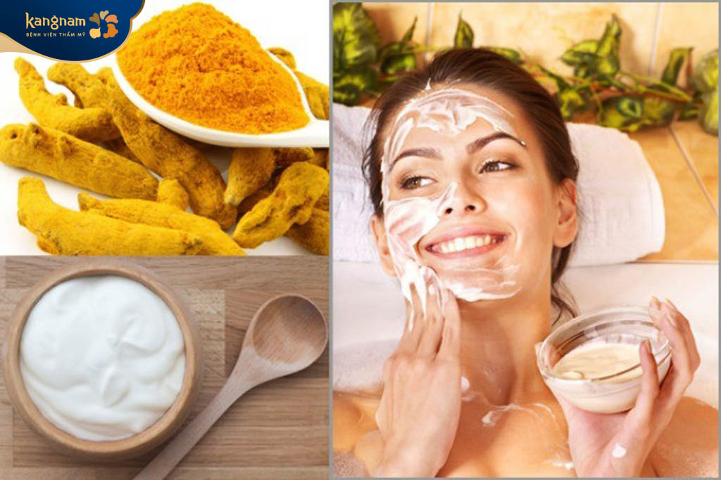 Cách trị mụn bọc sưng to với sữa chua, nghệ