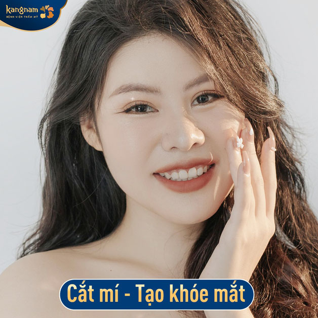 Khách hàng sở hữu đôi mắt trong veo, đường mí đẹp sau khi cắt mí tại Kangnam