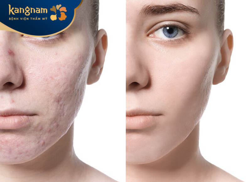 Sẹo hình thành tại nhiều vị trí trên cơ thể