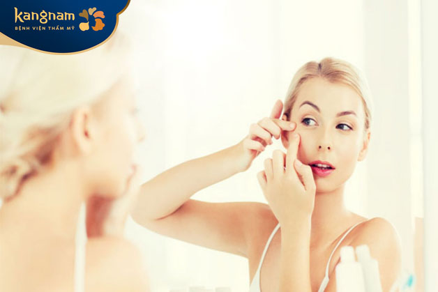 Chỉ nặn mụn khi mụn đã khô nhân, trồi nhân mụn ra ngoài