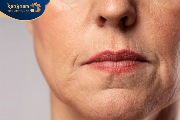 Mức độ lão hóa da ảnh hưởng đến chi phí