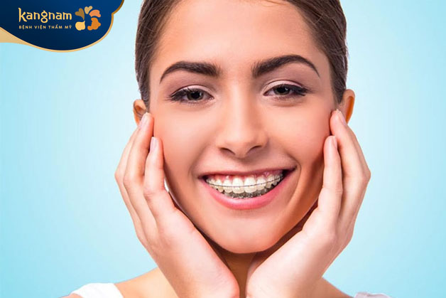 Niềng răng khiến má bị hóp