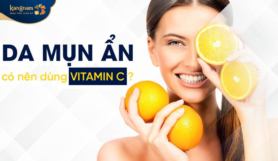 Mụn ẩn có thể dùng vitamin C