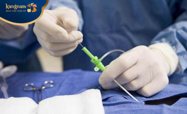 Đốt điện (Electrocautery)